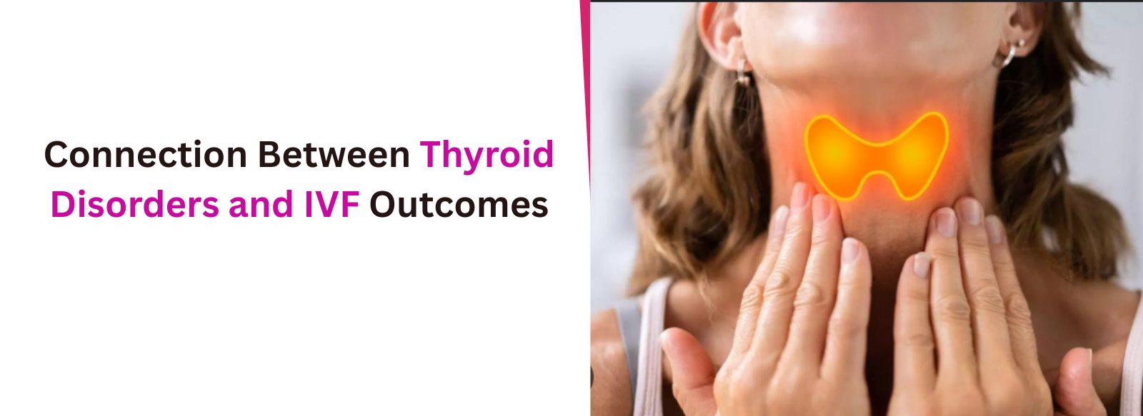 Connection Between Thyroid Disorders and IVF Outcomes