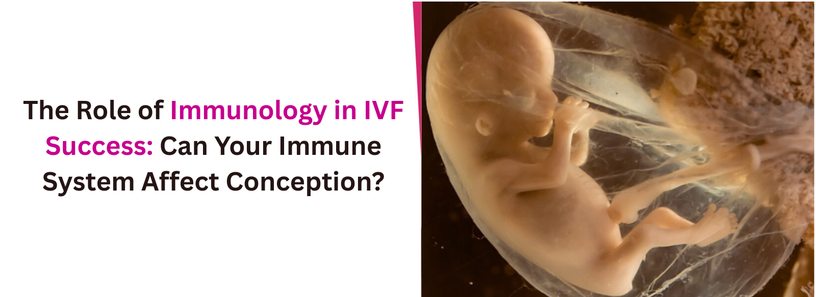 The Role of Immunology in IVF Success: Can Your Immune System Affect Conception?