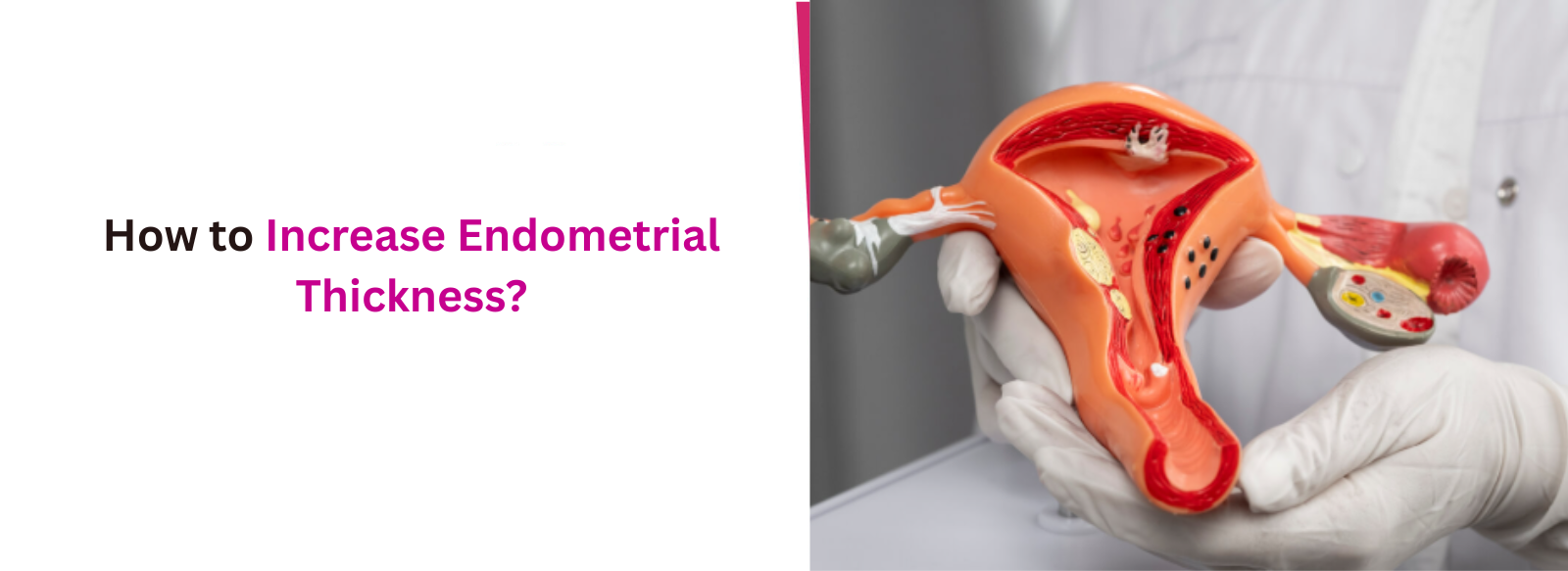 How to Increase Endometrial Thickness?