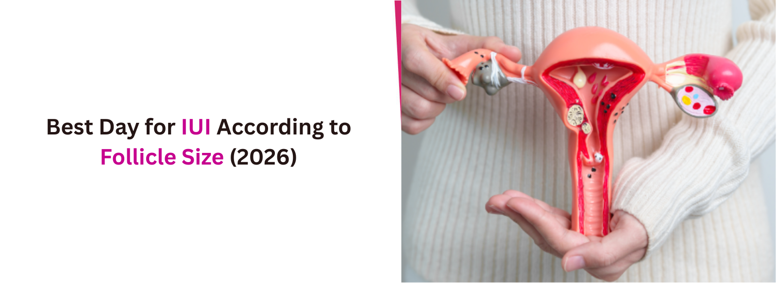 Best Day for IUI According to Follicle Size (2026)