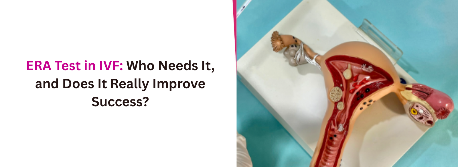 ERA Test in IVF: Who Needs It, and Does It Really Improve Success?
