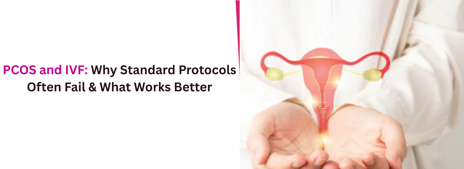 PCOS and IVF: Why Standard Protocols Often Fail & What Works Better