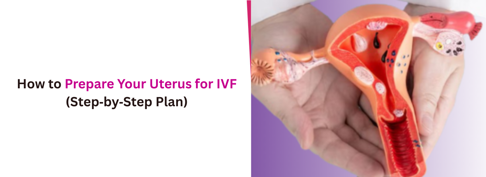 How to Prepare Your Uterus for IVF (Step‑by‑Step Plan)