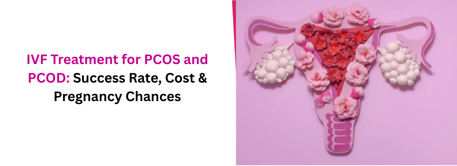 IVF Treatment for PCOS and PCOD: Success Rate, Cost & Pregnancy Chances