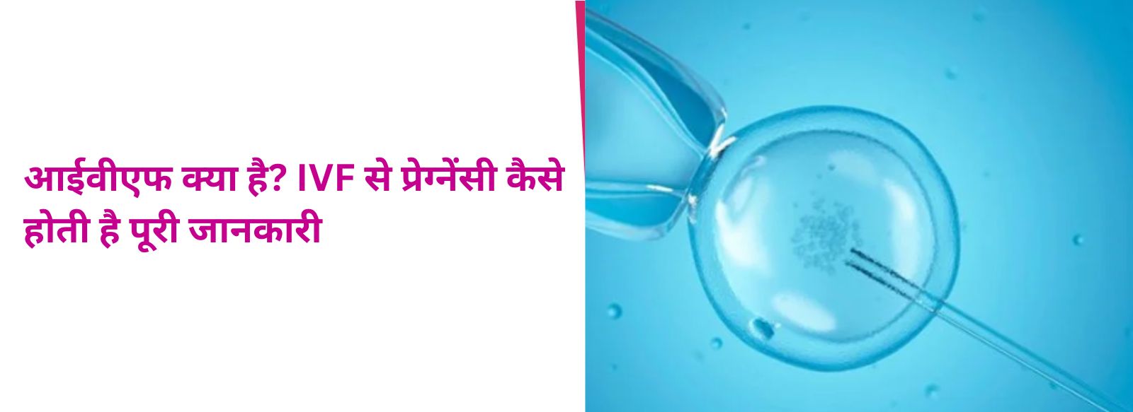 आईवीएफ क्या है? IVF से प्रेग्नेंसी कैसे होती है पूरी जानकारी