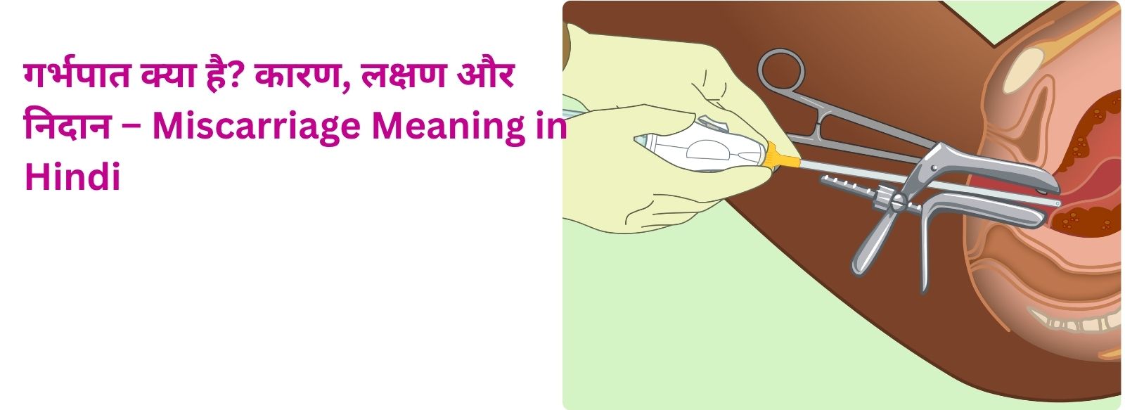 गर्भपात क्या है? कारण, लक्षण और निदान – Miscarriage Meaning in Hindi