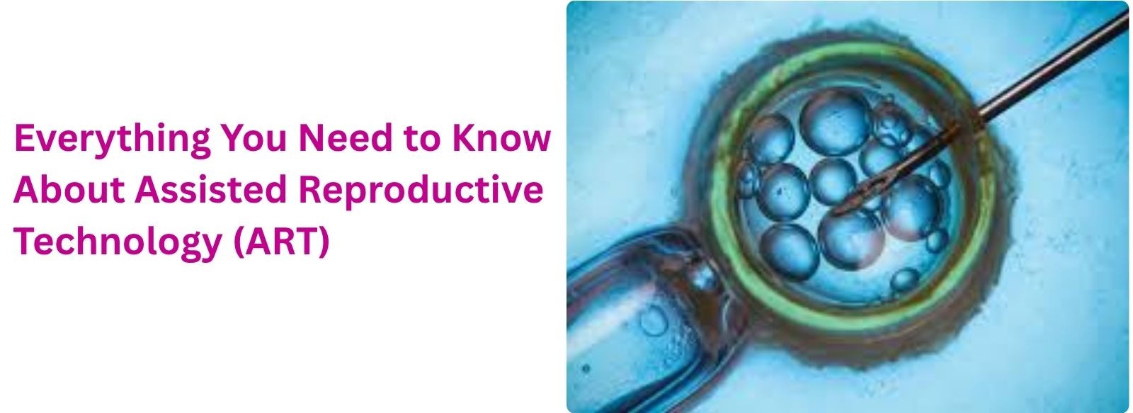 Everything You Need to Know About Assisted Reproductive Technology (ART)