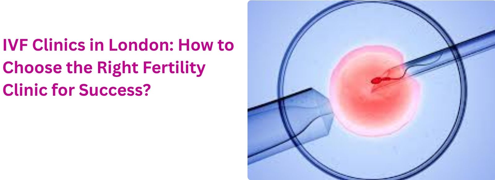 IVF Clinics in London: How to Choose the Right Fertility Clinic for Success?