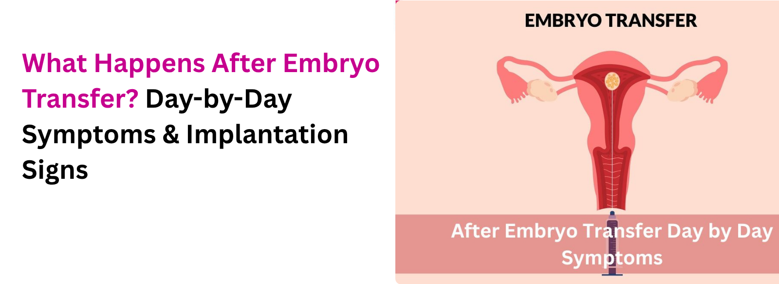 What Happens After Embryo Transfer? Day-by-Day Symptoms