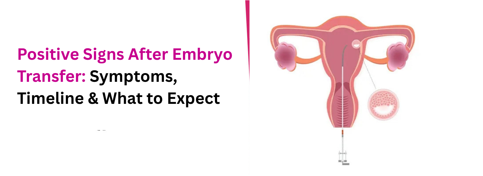 Positive Signs After Embryo Transfer: Symptoms, Timeline & What to Expect