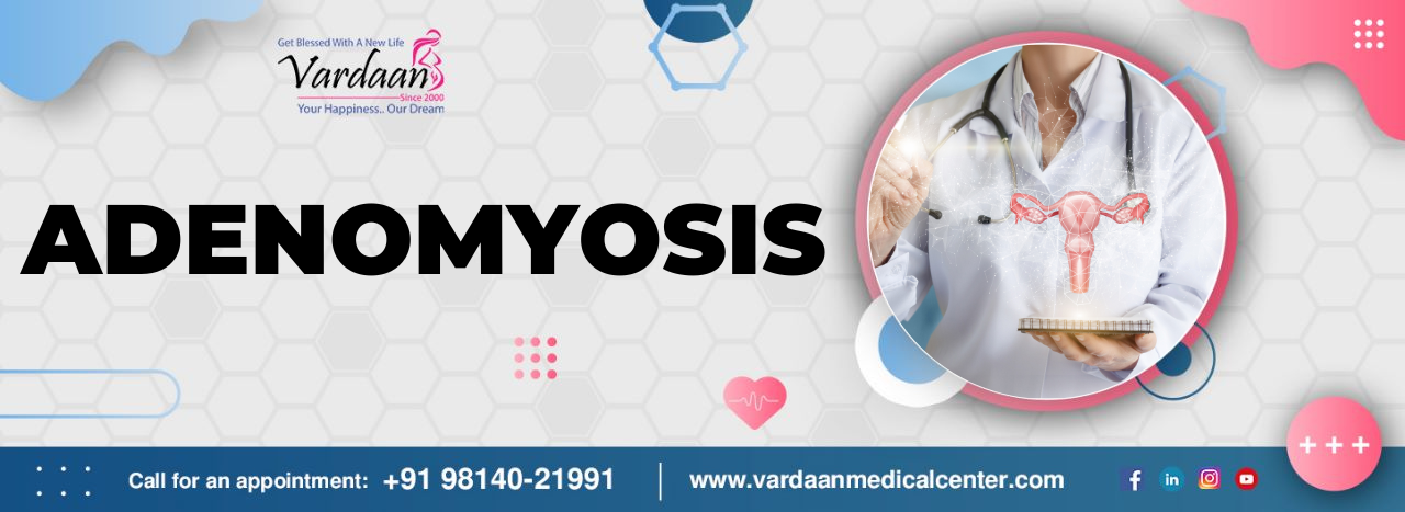 What is Adenomyosis? its Causes, Symptoms, and Management