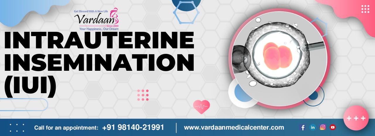 A Guide to IUI (Intrauterine insemination) - From Procedure to Risks to Achieving Pregnancy