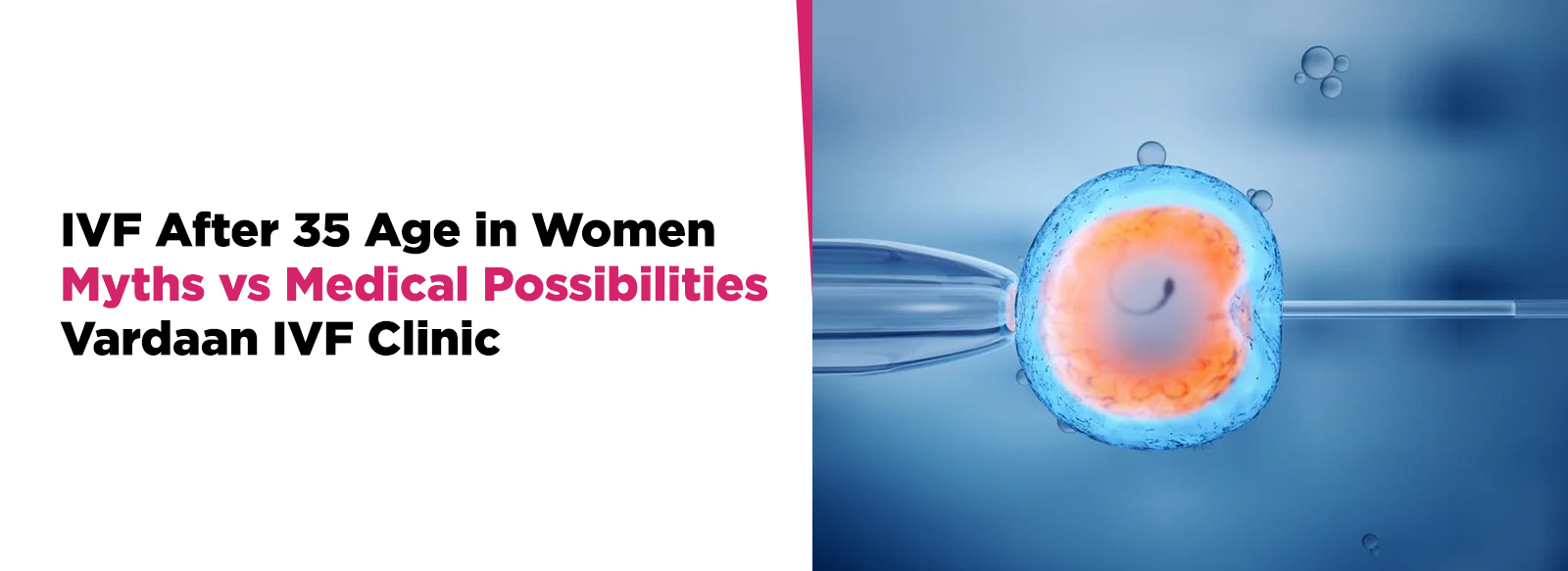 IVF After 35 Age in Women: Myths vs Medical Possibilities