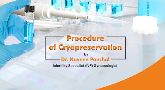 Procedure of Cryopreservation