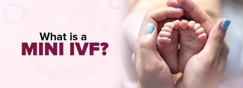 What is a Mini IVF Treatment? Complete Guide to Minimal Stimulation IVF