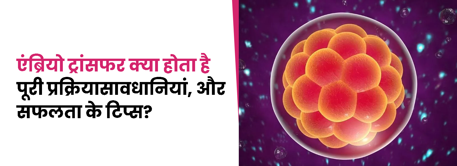 embryo transfer