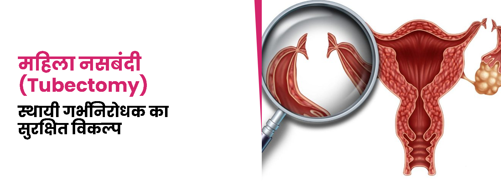 Does-obsity-affect-male-infertility