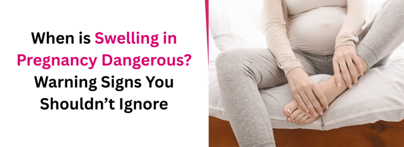 When is Swelling in Pregnancy Dangerous? Warning Signs You Shouldn’t Ignore